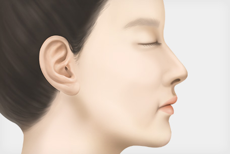 수술 탄력을 회복
